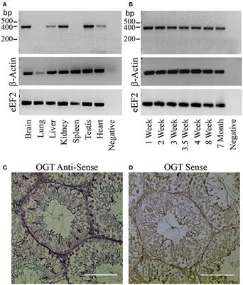 Changes in Protein O-GlcNAcylation During Mouse Epididymal Sperm Maturation